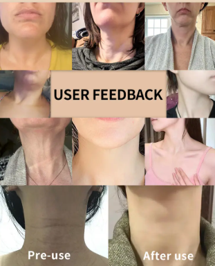 Crema Reafirmante y Lifting para Cuello